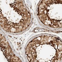 Anti-CNTROB antibody produced in rabbit 