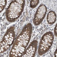 Anti-COASY antibody produced in rabbit 