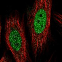 Anti-COL12A1 antibody produced in rabbit 