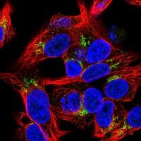 Anti-COL18A1 antibody produced in rabbit 