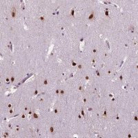 Anti-COL23A1 antibody produced in rabbit 