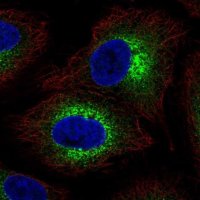 Anti-COL4A6 antibody produced in rabbit 