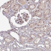 Anti-COL8A2 antibody produced in rabbit