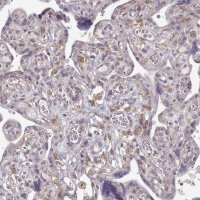 Anti-COL8A2 antibody produced in rabbit