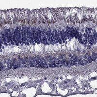 Anti-COL9A1 antibody produced in rabbit 