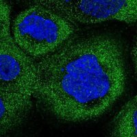 Anti-COLQ antibody produced in rabbit 