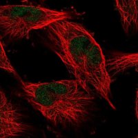 Anti-COMMD1 antibody produced in rabbit 