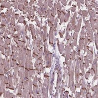 Anti-COMMD4 antibody produced in rabbit 