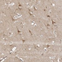 Anti-COPA antibody produced in rabbit