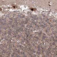 Anti-COPS4 antibody produced in rabbit HPA036894-100UL