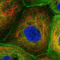Anti-CORO1B antibody produced in rabbit 