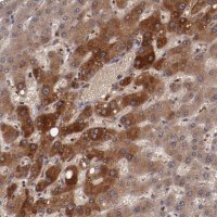 Anti-CP antibody produced in rabbit 