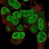 Anti-CPD antibody produced in rabbit 