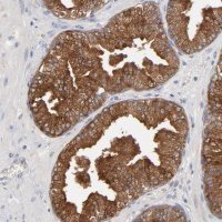 Anti-CPE antibody produced in rabbit