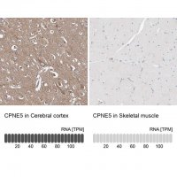 Anti-CPNE5 antibody produced in rabbit 