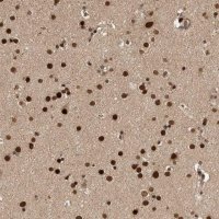 Anti-CPSF2 antibody produced in rabbit