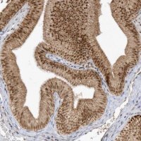 Anti-CPSF3 antibody produced in rabbit 