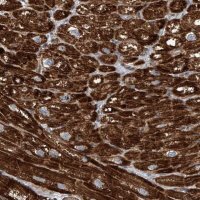 Anti-CPT1B antibody produced in rabbit 