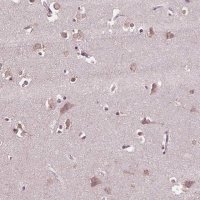 Anti-CPT1C antibody produced in rabbit 