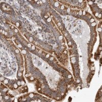 Anti-CPT2 antibody produced in rabbit