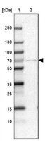 Anti-CPT2 antibody produced in rabbit