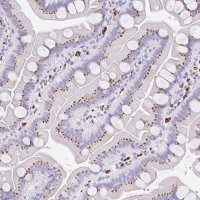 Anti-CPTP antibody produced in rabbit 