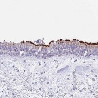 Anti-CPXM2 antibody produced in rabbit 