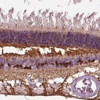 Anti-CRABP1 antibody produced in rabbit 