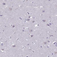 Anti-CRB2 antibody produced in rabbit 