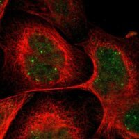 Anti-CRCP antibody produced in rabbit 
