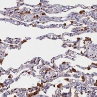 Anti-CRIP1 antibody produced in rabbit 