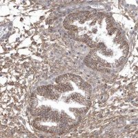Anti-CRIP3 antibody produced in rabbit HPA036198-100UL