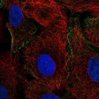 Anti-CRK antibody produced in rabbit 