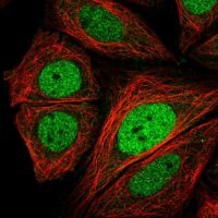 Anti-CRTC3 antibody produced in rabbit 
