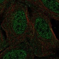 Anti-CSDC2 antibody produced in rabbit 