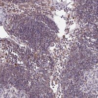 Anti-CSF3R antibody produced in rabbit 