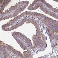 Anti-CSF3R antibody produced in rabbit 