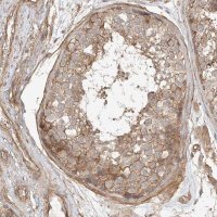 Anti-CSMD3 antibody produced in rabbit 