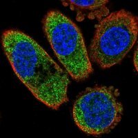 Anti-CSNK1A1 antibody produced in rabbit 
