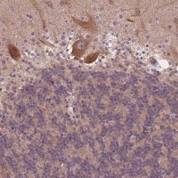 Anti-CSNK1G2 antibody produced in rabbit HPA056572-100UL