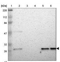Anti-CSNK2B antibody produced in rabbit