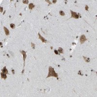 Anti-CSRNP3 antibody produced in rabbit HPA017905-100UL