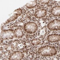 Anti-CTCF antibody produced in rabbit