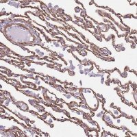 Anti-CTDSPL antibody produced in rabbit 