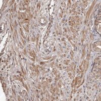 Anti-CTGF antibody produced in rabbit 