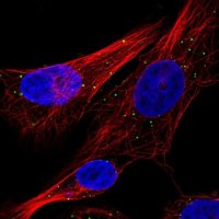 Anti-CTSC antibody produced in rabbit 