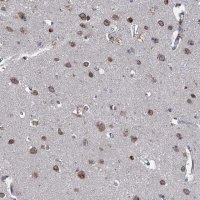 Anti-CTU2 antibody produced in rabbit 