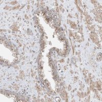 Anti-CUX1 antibody produced in rabbit