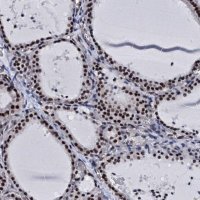 Anti-CWC15 antibody produced in rabbit 