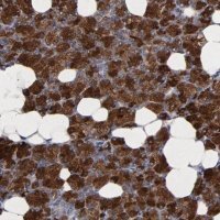 Anti-CXADR antibody produced in rabbit 